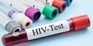 HIV/AIDS: PREEFEITURA E UFSC REALIZAM AÇÕES DE PREVENÇÃO E TRATAMENTO EM FLORIANÓPOLIS