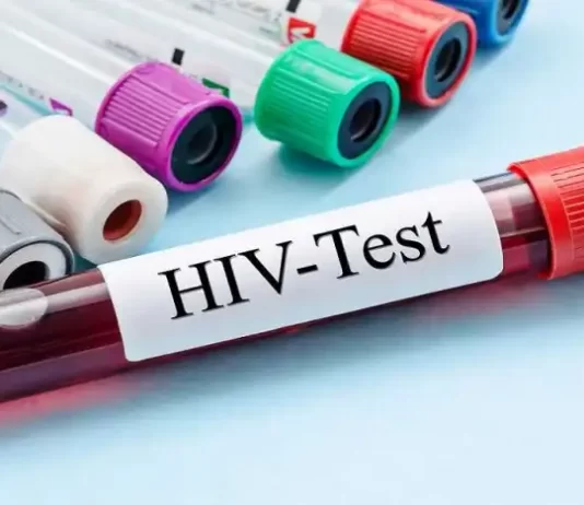 HIV/AIDS: PREEFEITURA E UFSC REALIZAM AÇÕES DE PREVENÇÃO E TRATAMENTO EM FLORIANÓPOLIS